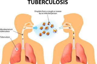 obat tbc paling ampuh di apotik k24