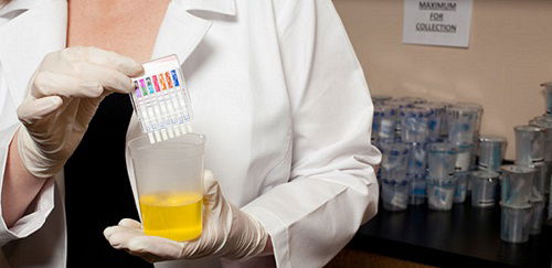 workplace drug test in Australia