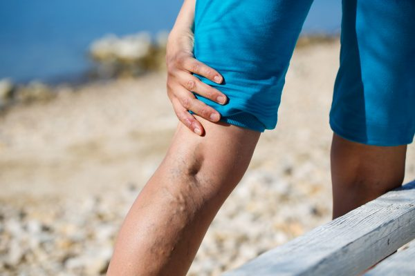 treatments for leg cramps