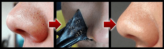 Pod images