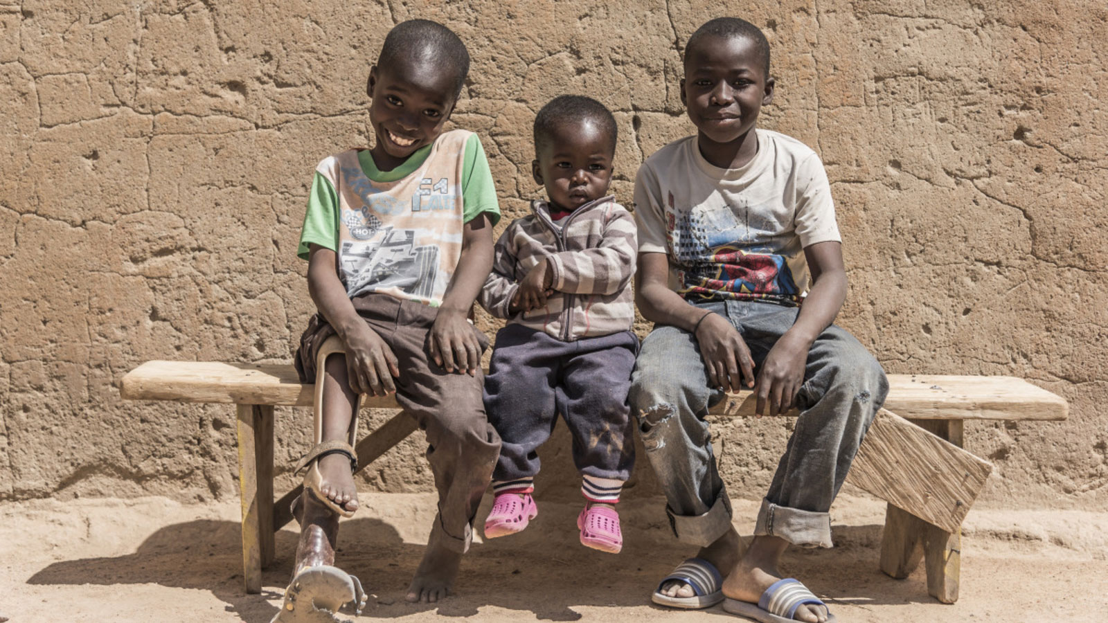 Samadou receives rehabilitation from HI in Burkina Faso