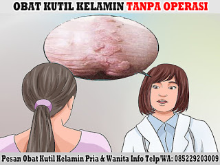 Obat Kutil Kelamin