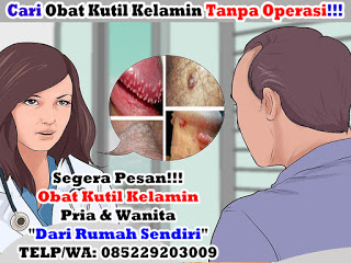 Obat Kutil Kelamin