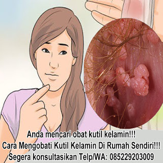 Obat Kutil Untuk Kutil Kelamin Dan Anus