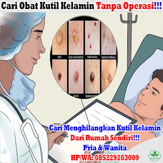 Obat Kutil Kelamin