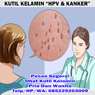 Obat Kutil Kelamin