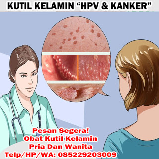 Obat Kutil Kelamin