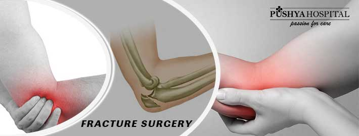 Fracture Surgery In Ahmedabad