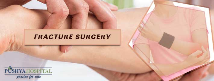 Fracture Surgery In Ahmedabad 
