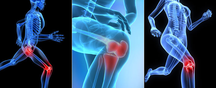 Joint Replacement Surgery Doctor in Ahmedabad 