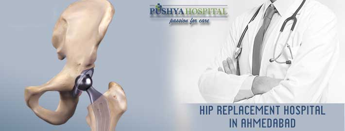 Hip Replacement Hospital in Ahmedabad