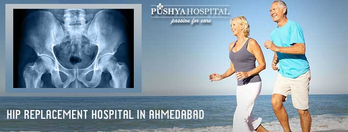 Hip Replacement Hospital in Ahmedabad