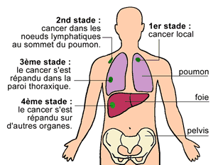 Résultat de recherche d'images pour 