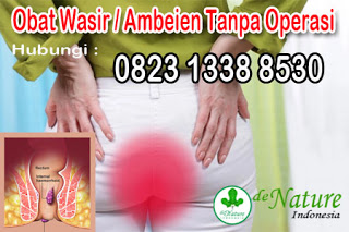 Nama Merk Obat Anus Sakit BAB Berdarah Paling Ampuh Di Apotik Kimia Farma