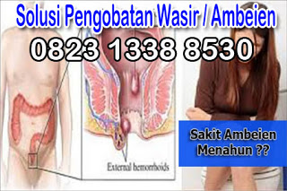 https://sediaobatwasir.blogspot.com/2019/07/nama-obat-ambeien-resep-dokter-paling.html