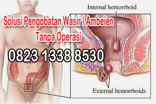 https://sediaobatwasir.blogspot.com/2019/07/merk-obat-ambeien-paling-ampuh-terbukti.html