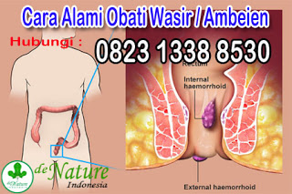 https://sediaobatwasir.blogspot.com/2019/07/alternatif-pengobatan-alami-wasir.html