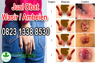 https://sediaobatwasir.blogspot.com/2019/08/jual-obat-kapsul-paling-ampuh.html