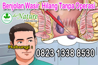 https://sediaobatwasir.blogspot.com/2019/09/krim-lotion-obat-ambeien-paling-ampuh.html