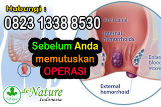 https://sediaobatwasir.blogspot.com/2019/09/jual-produk-obat-herbal-wasir-terampuh.html