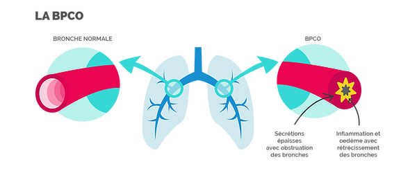 comprendre_anatomieetphysiopathologie_01