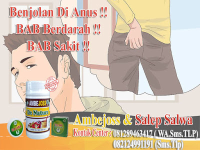 Cara - Cara Mengempeskan muncul benjolan kecil di lubang anus BAB