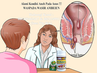 Salah satu Cara Menghilangkan benjolan di anus bagian luar