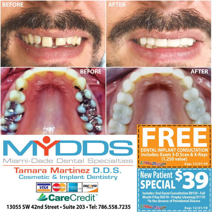 Miami Dental Coupons