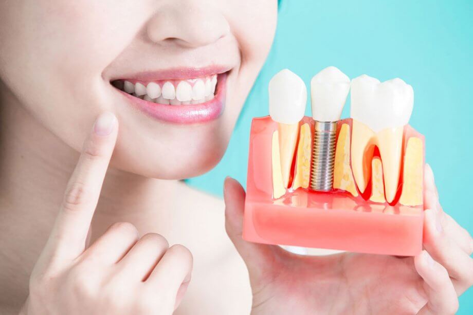 Dental Implants near me