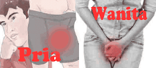 obat kencing nanah pada pria dan wanita
