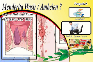 Inilah cara ampuh mengobati wasir stadium 3-4 tanpa operasi dan aman