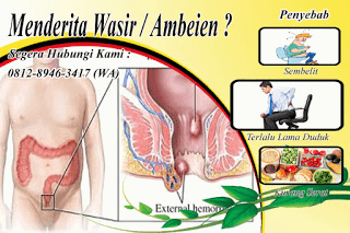 Begini cara menghilangkan benjolan ambeien dalam atau internal