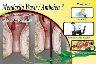 Ini dia cara menghilangkan benjolan ambeien dengan alami dan ampuh