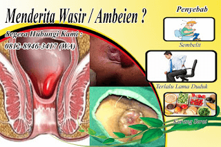 1 Cara Mengobati Ambeien Stadium (3) Secara Alami Tradisional