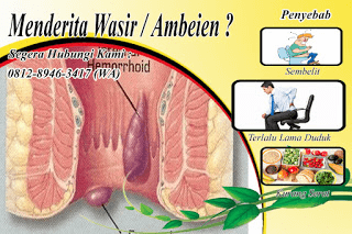 Lakukan Cara Mengobati Ambeien Stadium 3 Agar Sembuh Tanpa Operasi