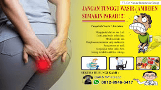 Contoh gambar obat wasir alami tingkat/stadium 1 2 3 dan 4 yang paling ampuh