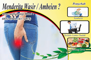 Harga dan Merk Obat Wasir Ambeien Stadium 3 Di Apotik Umum