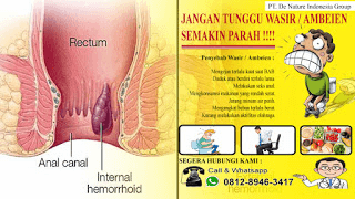 Nama kapsul dan harga obat wasir paling ampuh di apotik umum