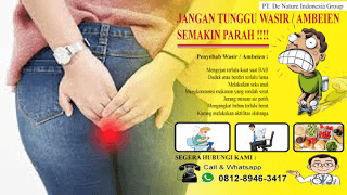 Ini dia yang anda cari obat tradisional wasir