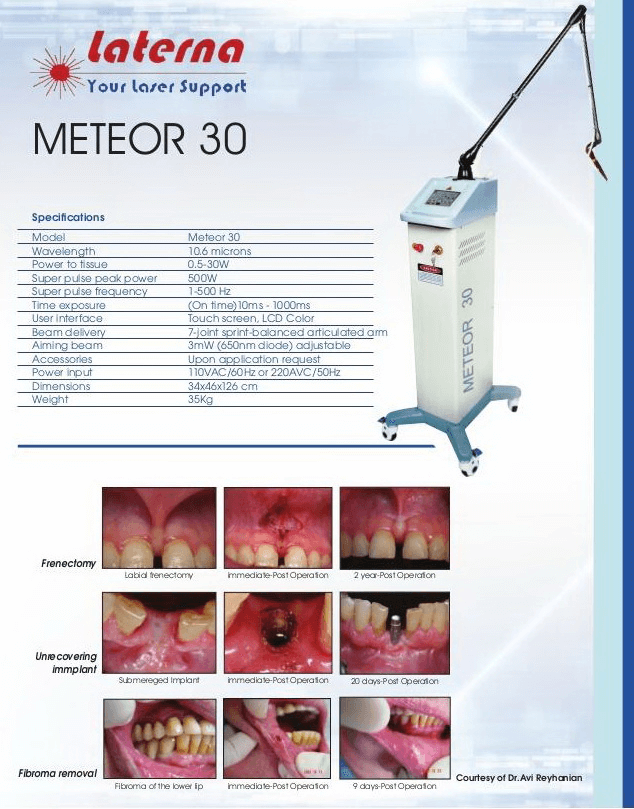 Meteor Brochure