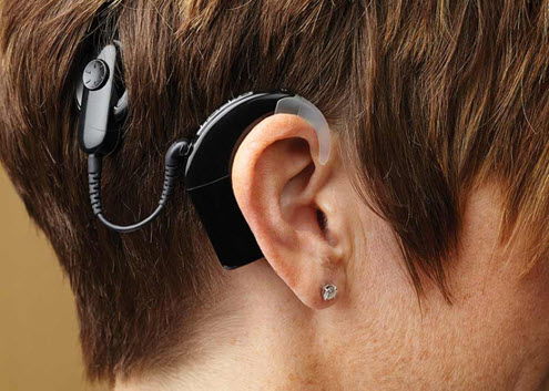 At Singapore, Points to Do after Cochlear Implant