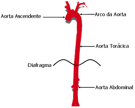 Porciones de la arteria aorta