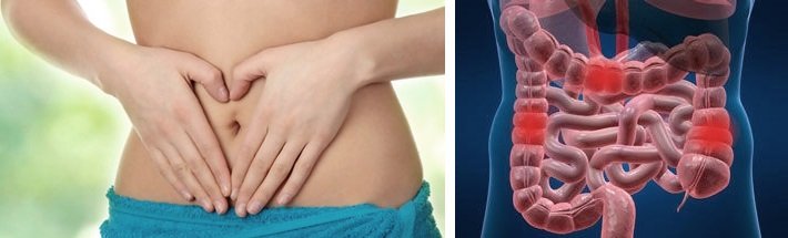 how to cleanse intestinal bacteria