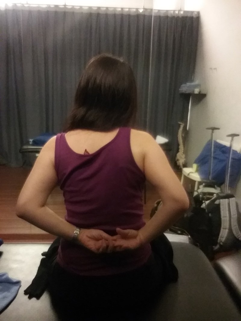 Physical Treatment for Scoliosis