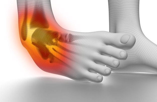 Best Physiotherapy for Ankle Sprain