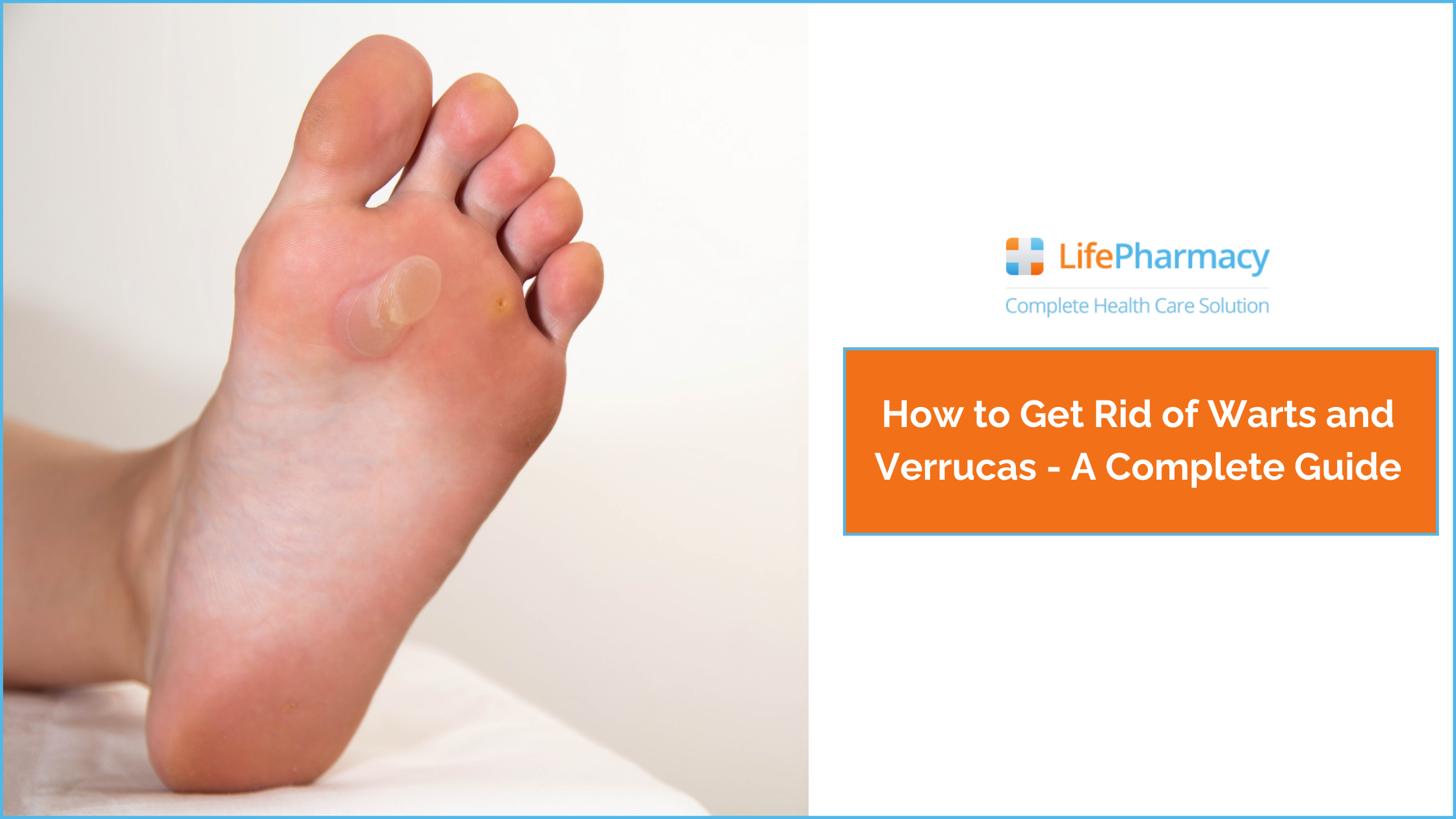 How to Get Rid of Warts and Verrucas - A Complete Guide