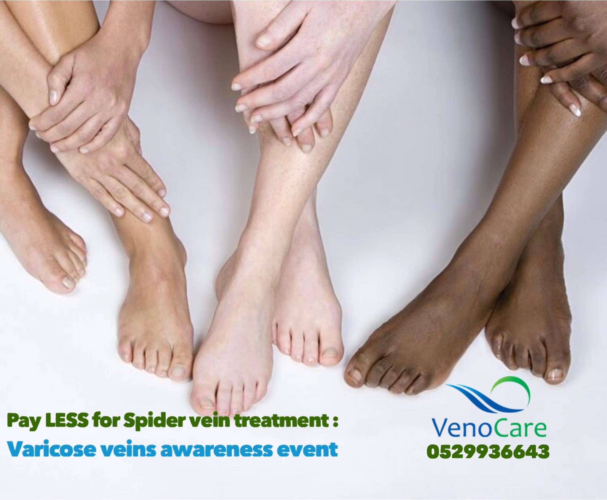 One Stop Clinic for Varicose Veins