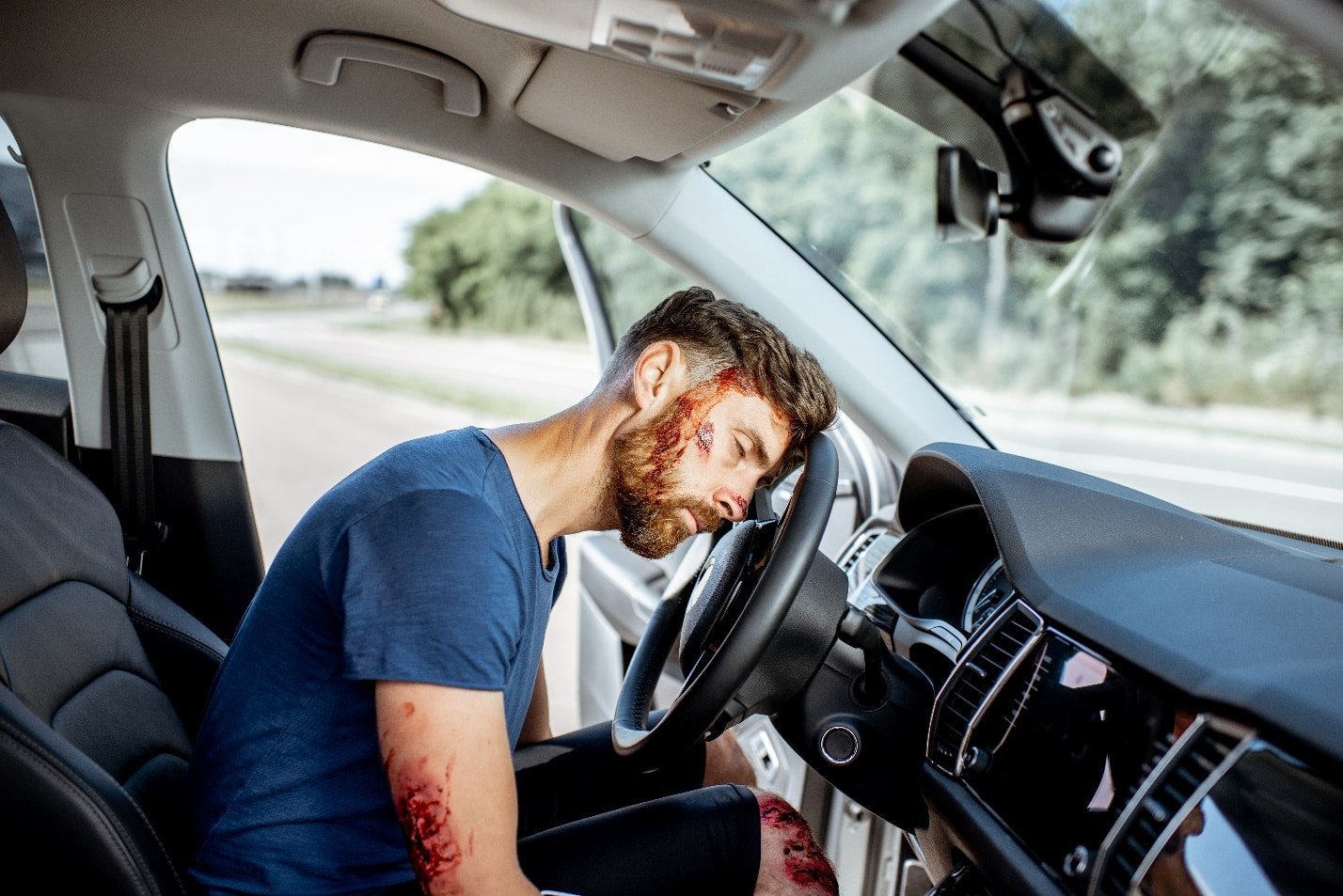 Car crash injuries Symptoms