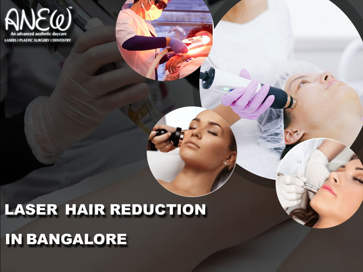 Laser Hair reduction in Bangalore 
