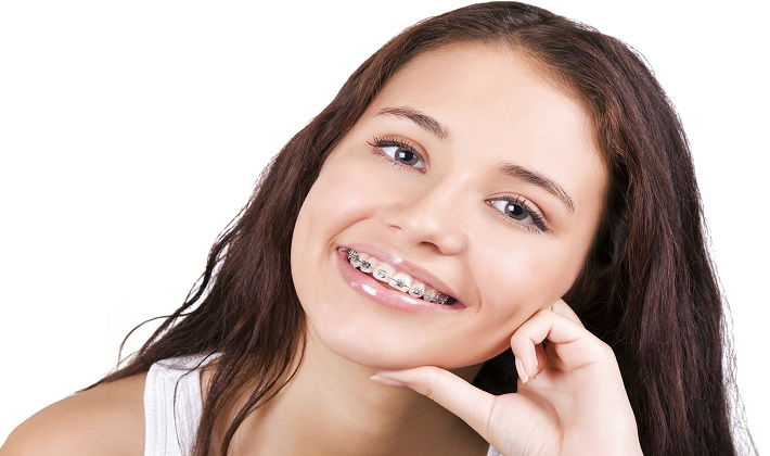 Braces specialist in Ahmedabad